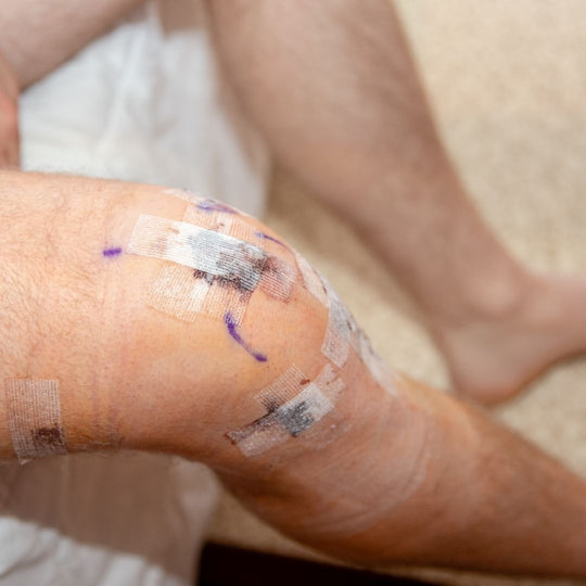 ACL Protocol
