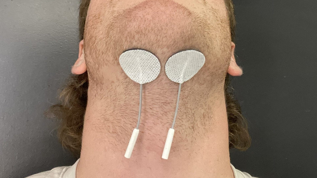 Using mTrigger Biofeedback to Improve Dysphagia