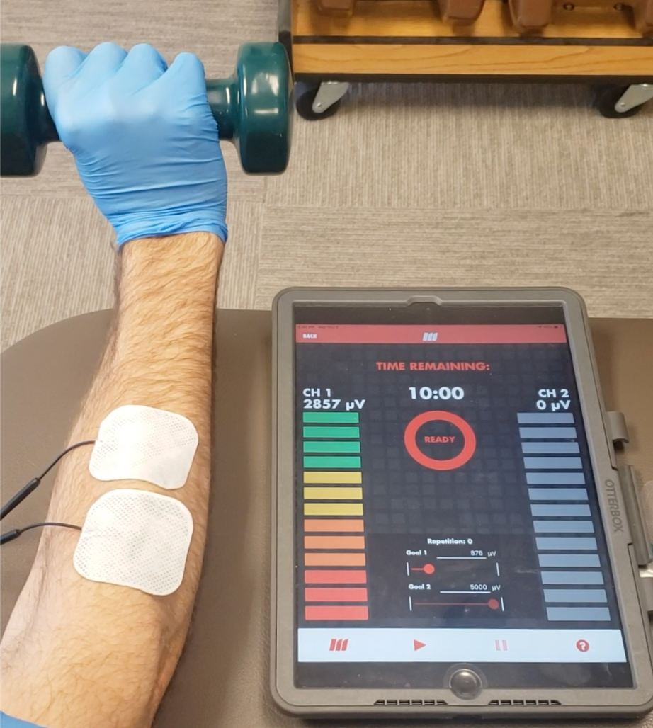 Improving Function and Independence After Stroke with mTrigger