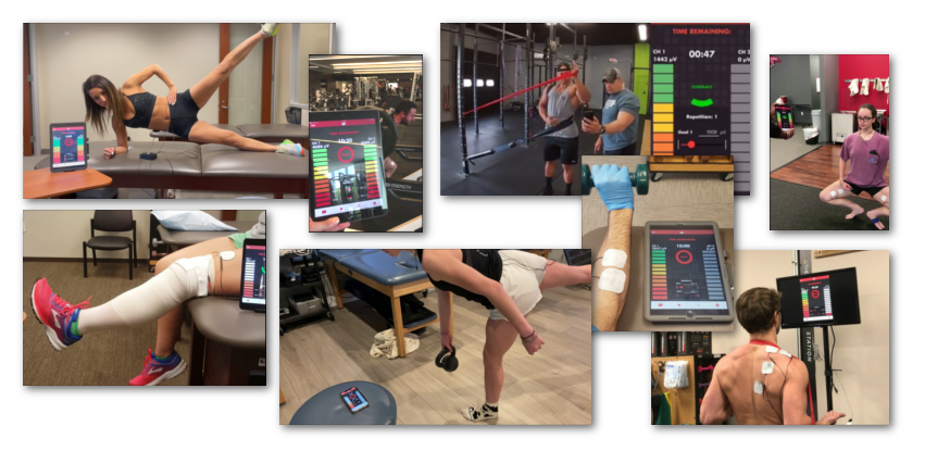 Comparing mTrigger Biofeedback to Traditional Rehab