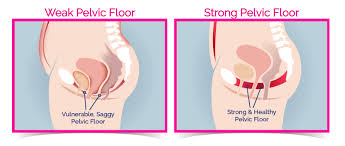 Strengthening the Pelvic Floor with Biofeedback