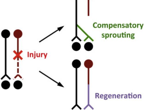 Using mTrigger Biofeedback to Redefine Progress after Spinal Cord Injury